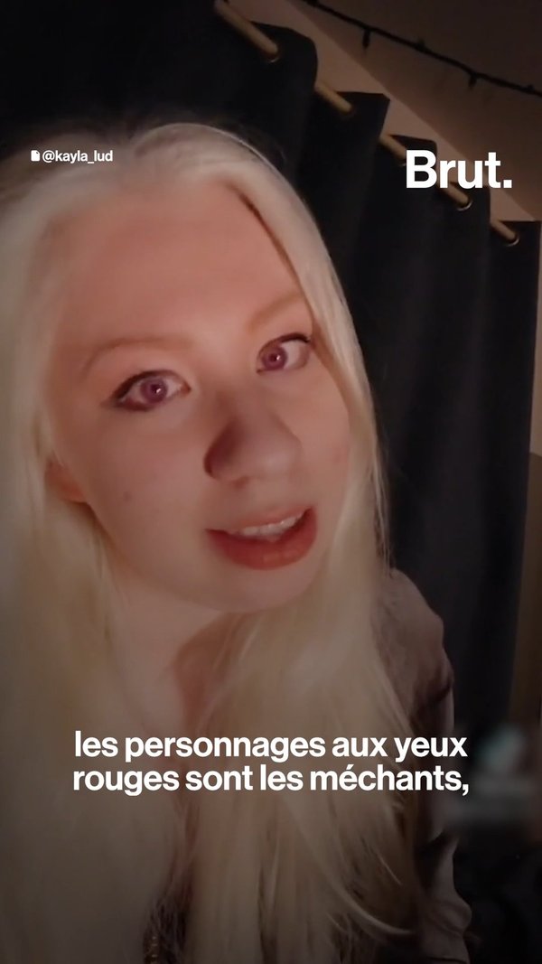 Lily Rader Anal Sex Video In Hd - Albinos, ils parlent de leur maladie sur les rÃ©seaux sociaux - L'ABESTIT