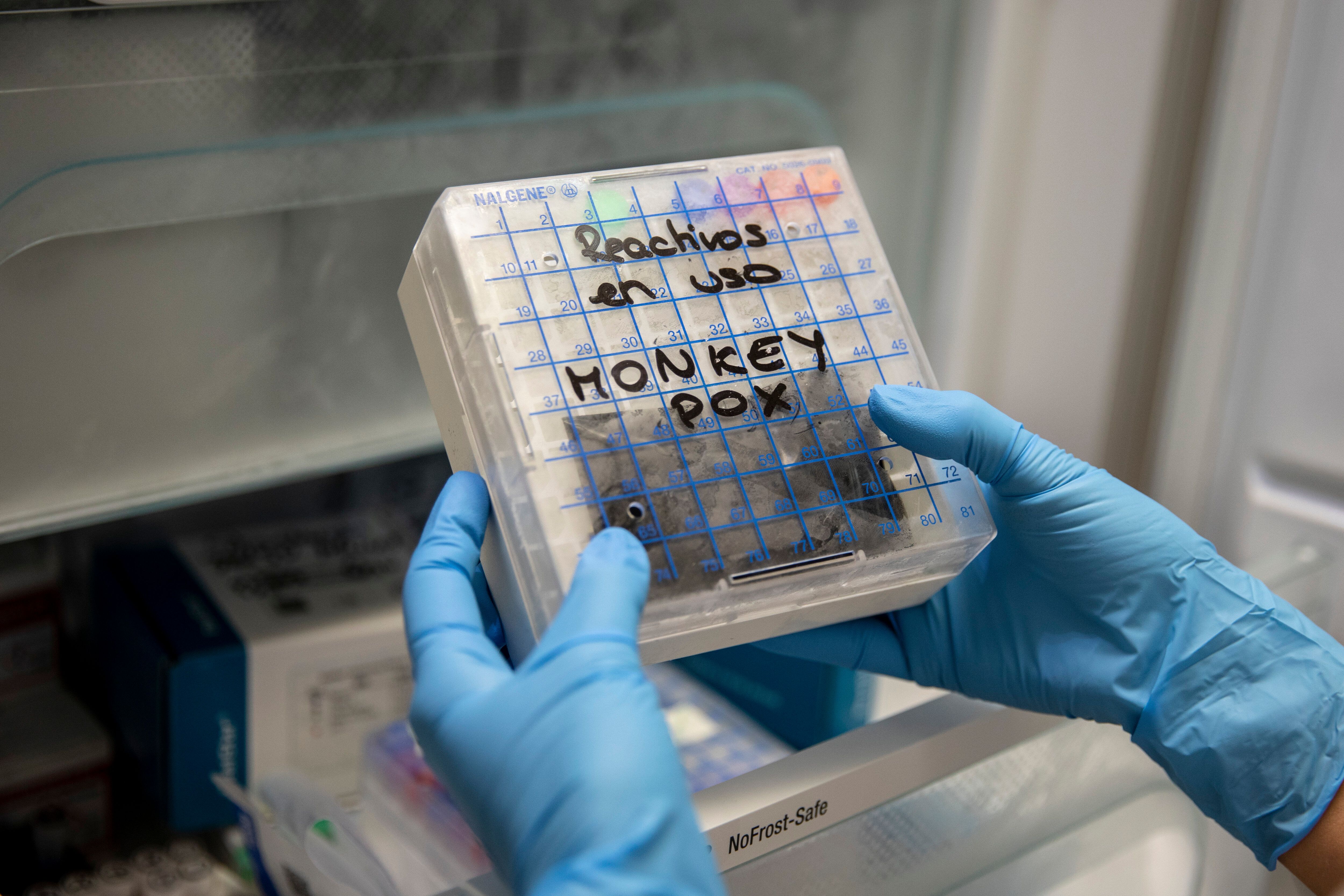 Des échantillons suspects de variole du singe dans un laboratoire de microbiologie de l'hôpital...